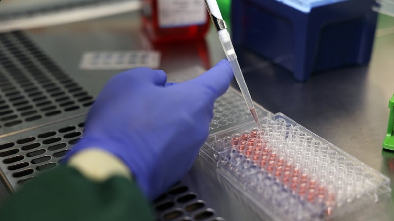 A scientist carefully pipettes samples into a 96-well micro plate as part of laboratory analysis.